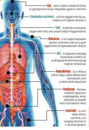 ez a férgek leggyakoribb gyógymódja papillom entfernen lassen